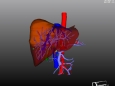 利用3D可视化技术术前精确诊断，血管与介入科成功完成了一例复杂的肝血管瘤精准介入手术